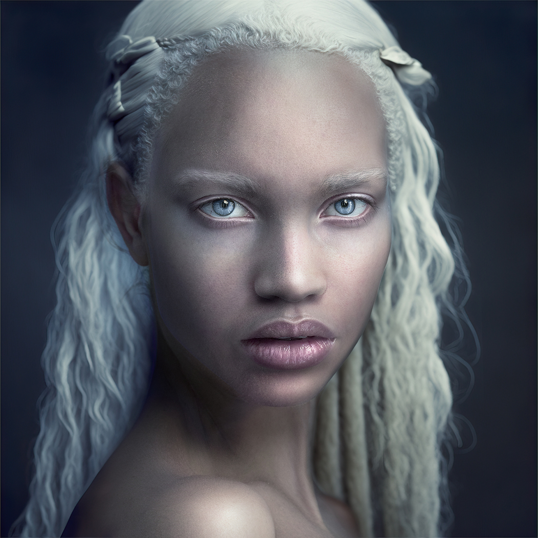 Exquisite Beauty