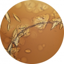 CRYSTALLIZATION